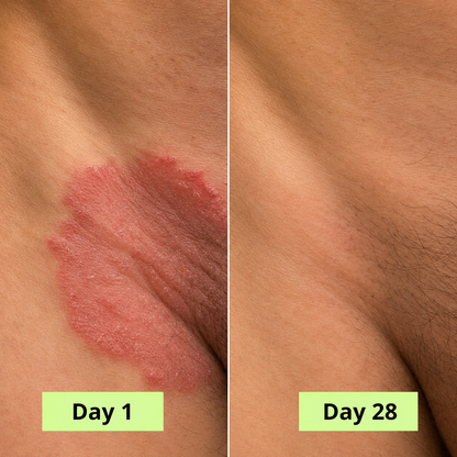 Onela® Antifungal Purifying Soap