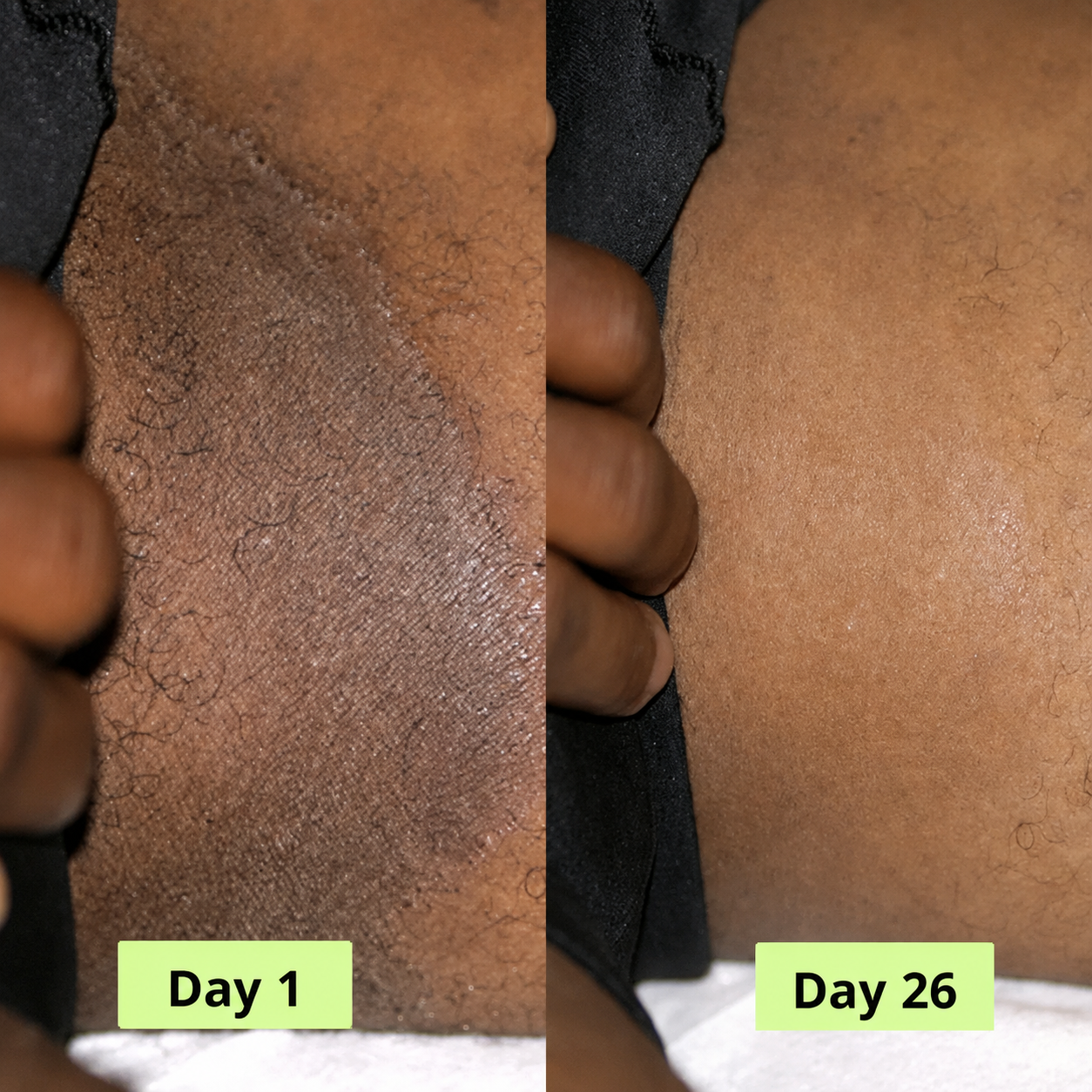 Onela® Antifungal Purifying Soap