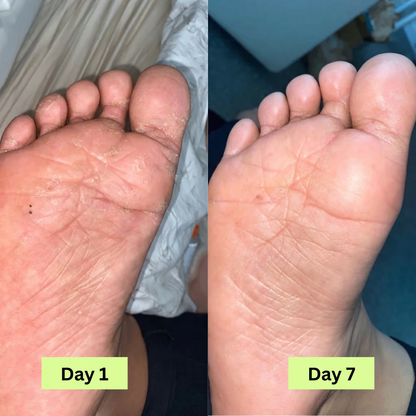Onela® Antifungal Purifying Soap