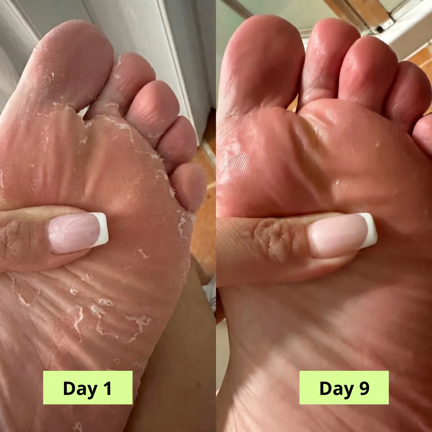Onela® Antifungal Purifying Soap